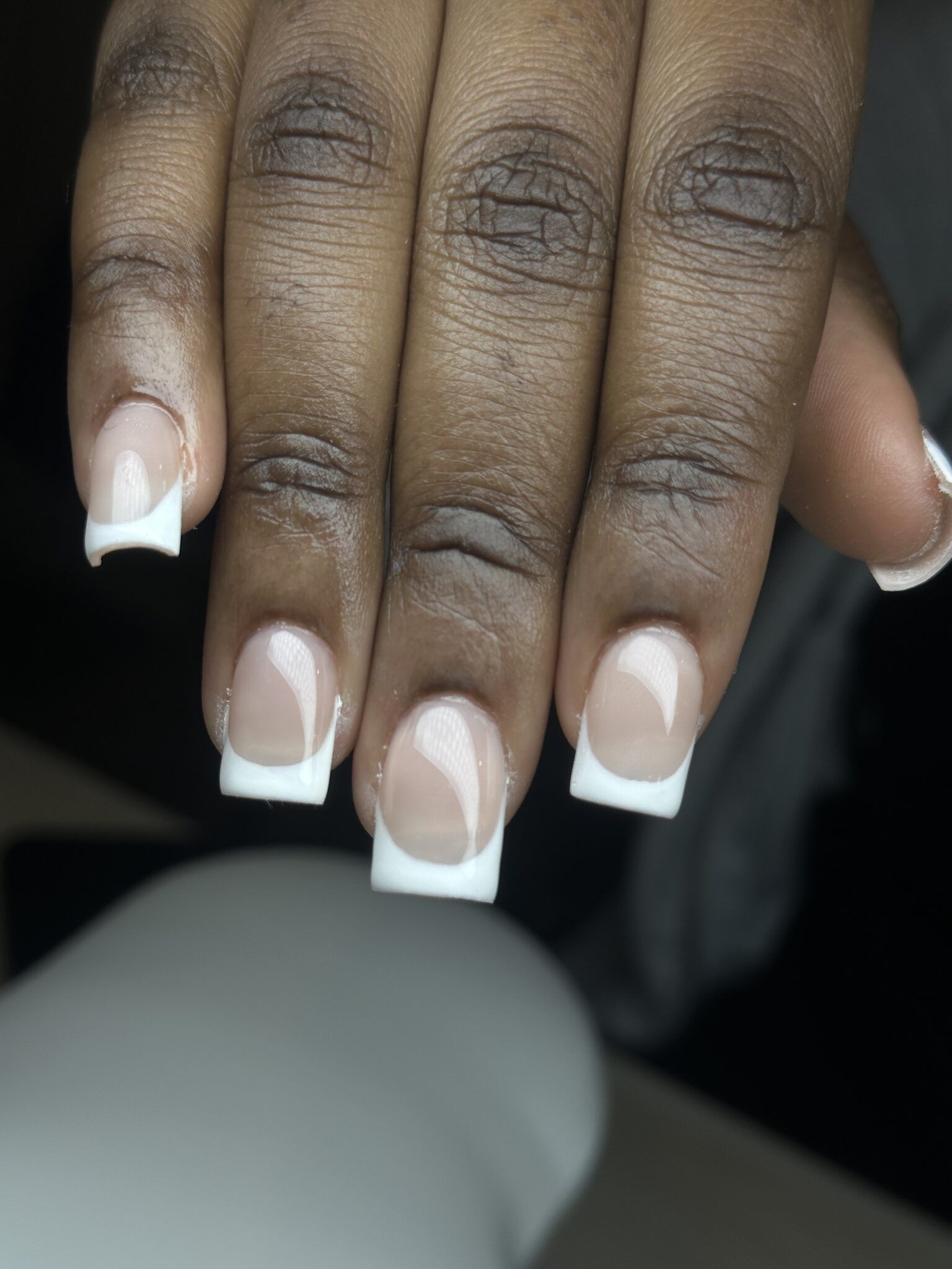 Biogel